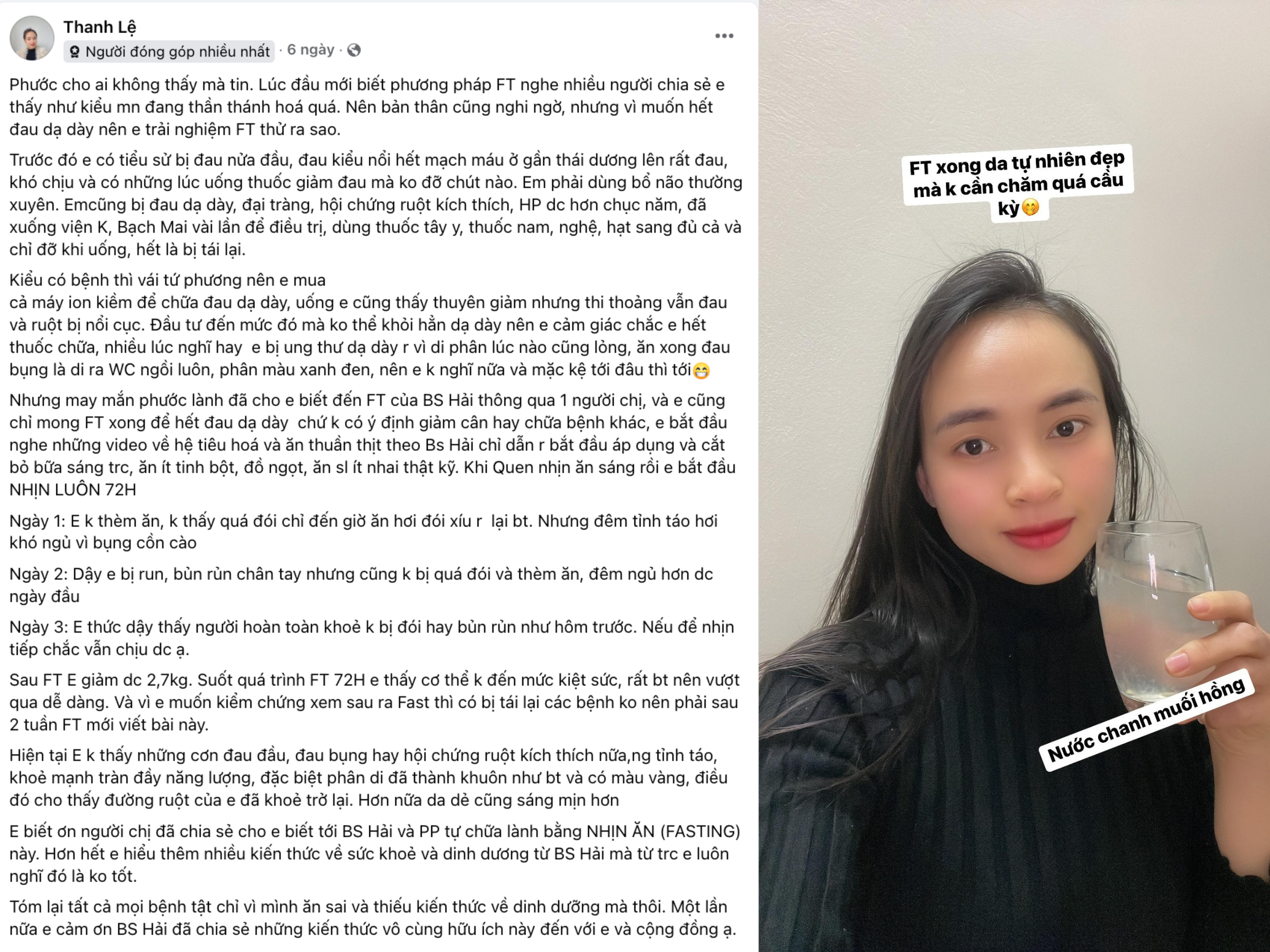 2 tuần hết đau dạ dày mà không cần thuốc – Câu chuyện có thật của chị Thanh Lệ!