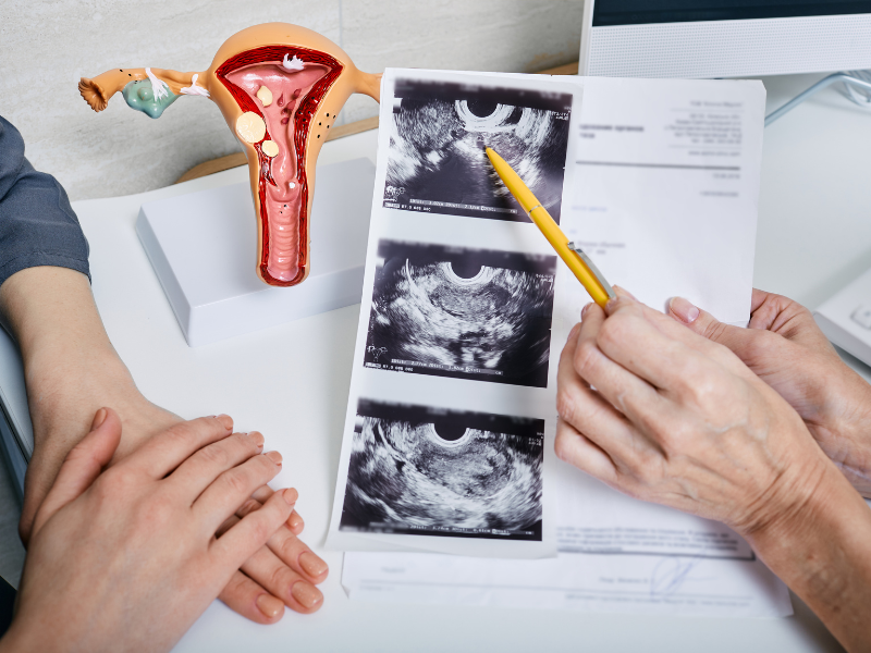 PCOS không phải do gen: Hiểu đúng về insulin để đảo ngược hội chứng buồng trứng đa nang