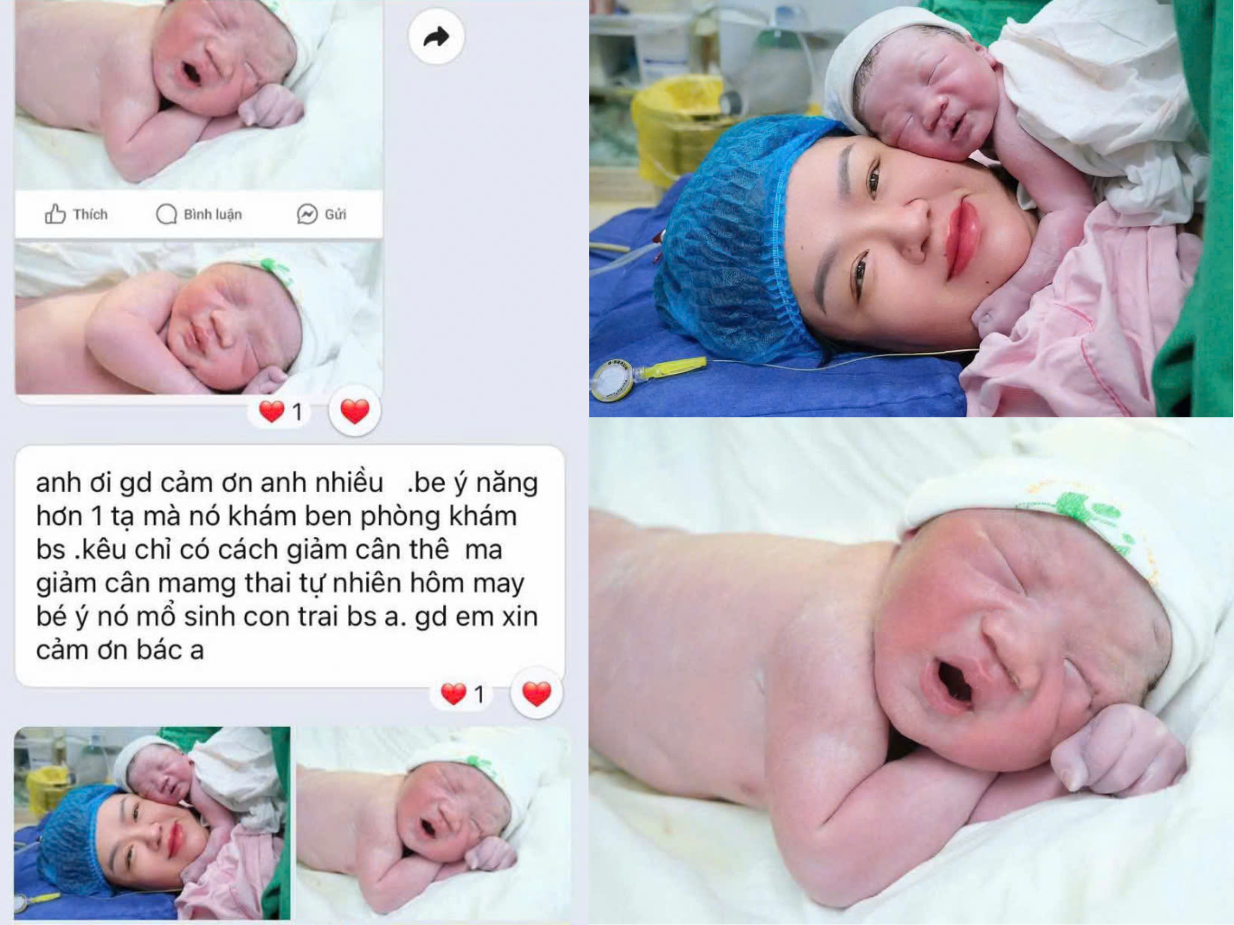 PCOS không phải do gen: Hiểu đúng về insulin để đảo ngược hội chứng buồng trứng đa nang