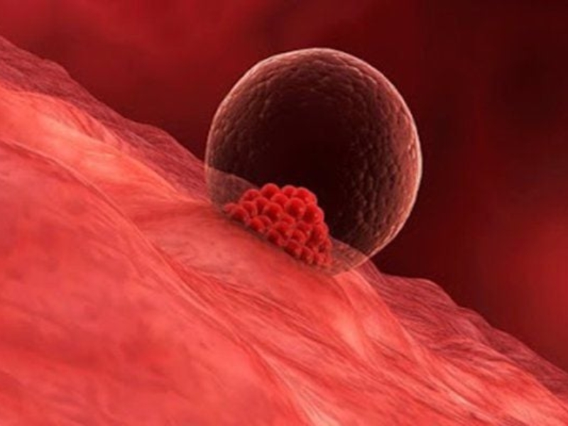 Dấu hiệu thai làm tổ sớm