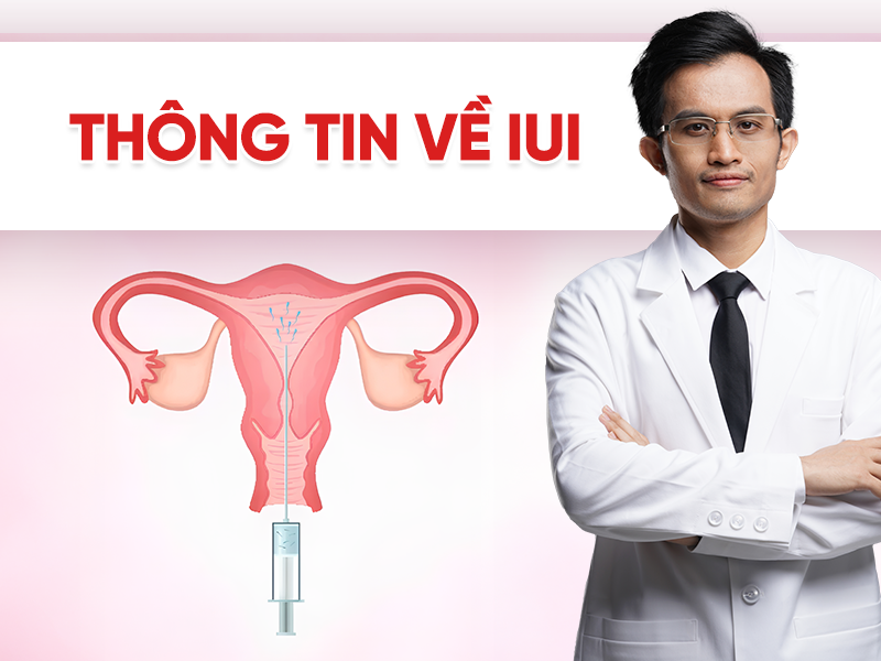 IUI là gì? Tìm hiểu chi tiết quy trình bơm tinh trùng vào buồng tử cung