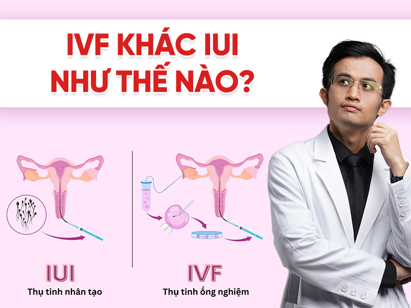 IVF khác IUI như thế nào? So sánh ưu điểm và hạn chế từng phương pháp