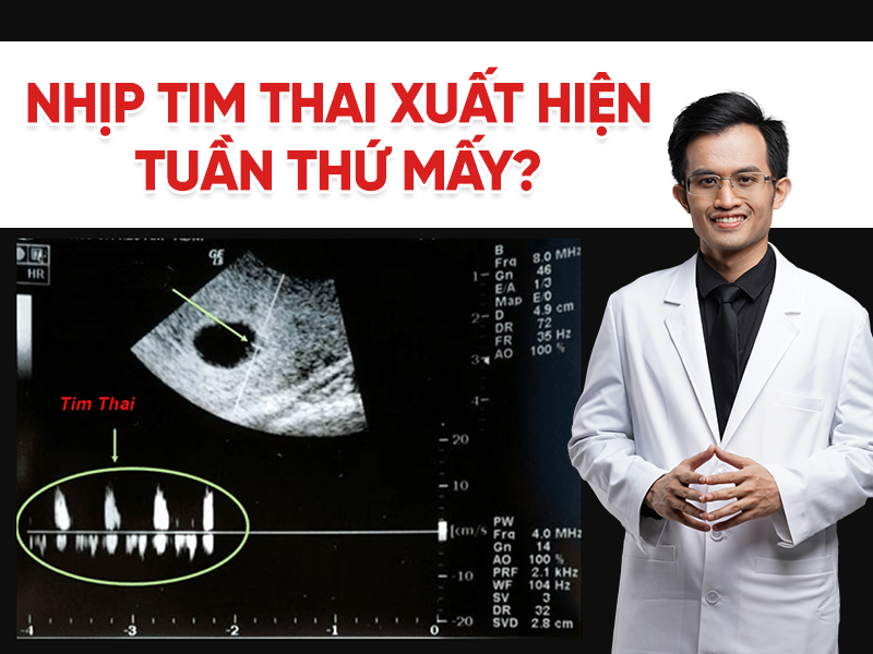Siêu âm thai bao nhiêu tuần thì thấy tim thai? Bác sĩ giải đáp chuẩn xác