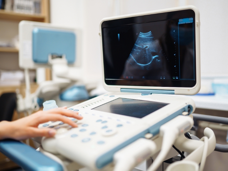 Siêu âm thai bao nhiêu tuần thì thấy tim thai?