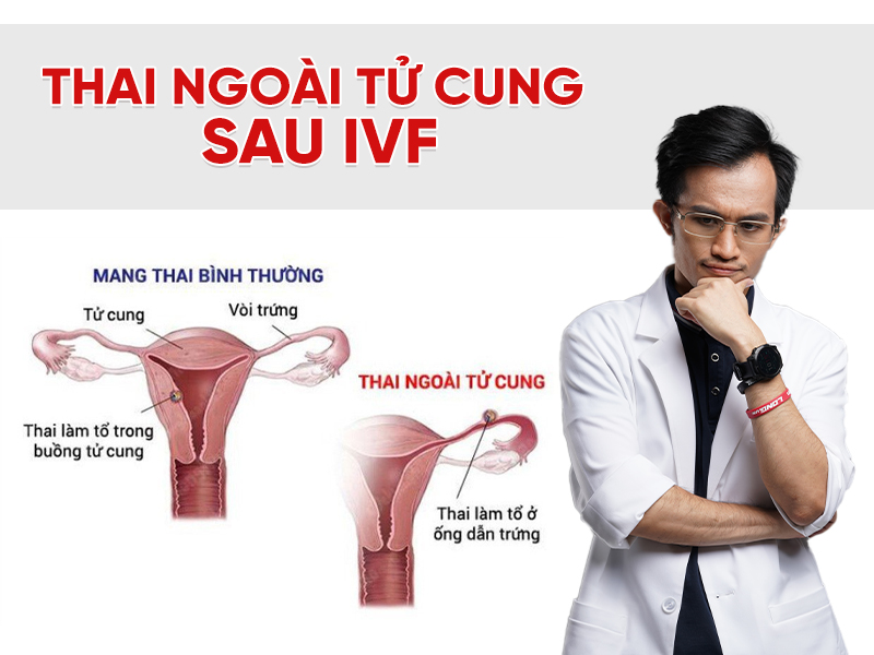 Thai ngoài tử cung sau IVF có nguy hiểm không? Bác sĩ Hải giải đáp
