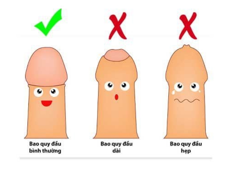 Dài bao quy đầu là gì?