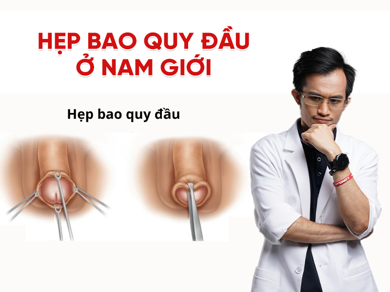Hẹp bao quy đầu ở nam giới: Nhận biết sớm và hướng điều trị hiệu quả