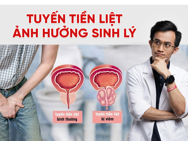 Tuyến tiền liệt ảnh hưởng sinh lý như thế nào? Cách bảo vệ sức khỏe nam giới sau tuổi 30