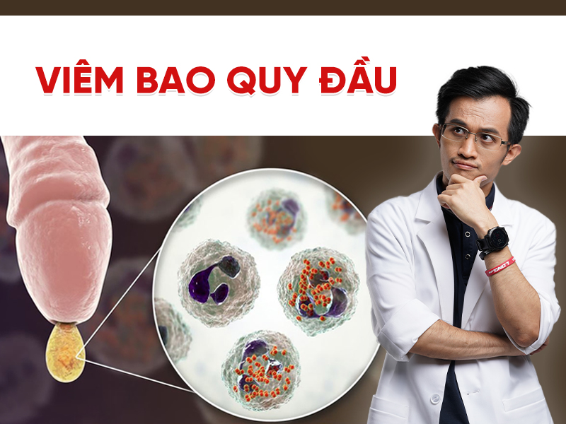 Viêm bao quy đầu: Nguyên nhân, triệu chứng và cách chữa trị an toàn tại nhà