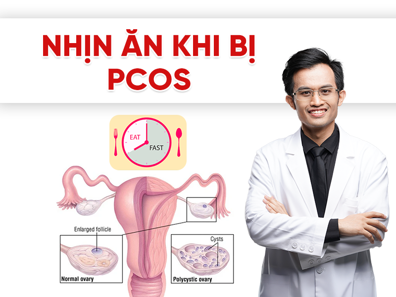 Nhịn ăn khi bị PCOS: Có nên không? Lợi ích, rủi ro và cách áp dụng đúng